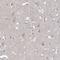 Rho GTPase Activating Protein 44 antibody, NBP1-93624, Novus Biologicals, Immunohistochemistry paraffin image 