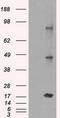 Cancer/Testis Antigen 1B antibody, CF500519, Origene, Western Blot image 