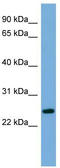 Zinc Finger C2HC-Type Containing 1B antibody, TA339862, Origene, Western Blot image 
