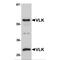 Protein Kinase Domain Containing, Cytoplasmic antibody, MBS150058, MyBioSource, Western Blot image 