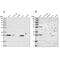 Biphenyl Hydrolase Like antibody, PA5-57798, Invitrogen Antibodies, Western Blot image 