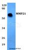 Matrix Metallopeptidase 21 antibody, A06124, Boster Biological Technology, Western Blot image 