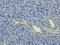 Intercellular Adhesion Molecule 1 antibody, orb339615, Biorbyt, Immunohistochemistry paraffin image 