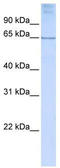 Homeobox protein DLX-4 antibody, TA335207, Origene, Western Blot image 