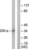 GDP Dissociation Inhibitor 2 antibody, orb314335, Biorbyt, Western Blot image 