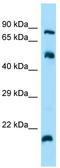 ADP-ribosylation factor-like protein 4C antibody, TA333934, Origene, Western Blot image 