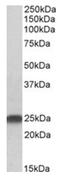 Lin-7 Homolog B, Crumbs Cell Polarity Complex Component antibody, AP31418PU-N, Origene, Western Blot image 