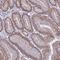 Mitochondrial Calcium Uptake 2 antibody, HPA045511, Atlas Antibodies, Immunohistochemistry frozen image 