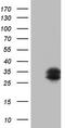Tissue Factor Pathway Inhibitor 2 antibody, TA805269S, Origene, Western Blot image 