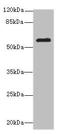 Matrix Metallopeptidase 19 antibody, LS-C676056, Lifespan Biosciences, Western Blot image 
