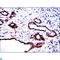 Protein Kinase N2 antibody, LS-C812748, Lifespan Biosciences, Immunohistochemistry paraffin image 