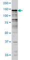 JHDM1B antibody, H00084678-M09, Novus Biologicals, Western Blot image 