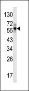 Fibrinogen Beta Chain antibody, 62-294, ProSci, Western Blot image 