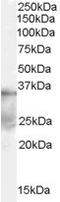 Deleted in azoospermia-like antibody, orb19110, Biorbyt, Western Blot image 