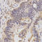 HCF-1 antibody, STJ23922, St John