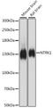 Neurotrophic Receptor Tyrosine Kinase 1 antibody, A15618, ABclonal Technology, Western Blot image 