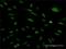 Exosome complex exonuclease RRP46 antibody, H00056915-M03, Novus Biologicals, Immunocytochemistry image 