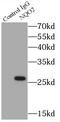 N-Ribosyldihydronicotinamide:Quinone Reductase 2 antibody, FNab05831, FineTest, Immunoprecipitation image 