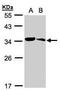 Metabolism Of Cobalamin Associated C antibody, PA5-21798, Invitrogen Antibodies, Western Blot image 