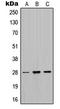 Myelin Protein Zero antibody, LS-C352534, Lifespan Biosciences, Western Blot image 