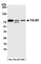 Palmdelphin antibody, A305-789A-M, Bethyl Labs, Western Blot image 