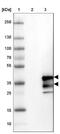 Charged multivesicular body protein 3 antibody, NBP1-89391, Novus Biologicals, Western Blot image 