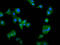 Calicin antibody, LS-C680240, Lifespan Biosciences, Immunofluorescence image 