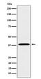 Leukotriene B4 Receptor antibody, M04622, Boster Biological Technology, Western Blot image 