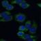 Follicle Stimulating Hormone Receptor antibody, FNab03231, FineTest, Immunofluorescence image 