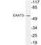 Excitatory amino acid transporter 3 antibody, LS-C199835, Lifespan Biosciences, Western Blot image 