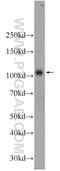 Complement C6 antibody, 17239-1-AP, Proteintech Group, Western Blot image 