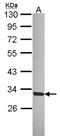 Small Glutamine Rich Tetratricopeptide Repeat Containing Alpha antibody, NBP2-20339, Novus Biologicals, Western Blot image 
