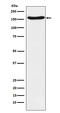 FA Complementation Group A antibody, M03662, Boster Biological Technology, Western Blot image 
