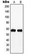 c-Myc antibody, MBS821193, MyBioSource, Western Blot image 