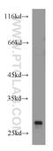 Rho GDP-dissociation inhibitor 1 antibody, 10509-1-Ig, Proteintech Group, Western Blot image 