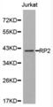 RP2 Activator Of ARL3 GTPase antibody, abx002305, Abbexa, Western Blot image 