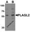Zinc finger protein PLAGL2 antibody, 7053, ProSci, Western Blot image 