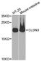 Claudin 3 antibody, A2946, ABclonal Technology, Western Blot image 