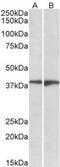 Sphingosine-1-Phosphate Receptor 5 antibody, 43-384, ProSci, Western Blot image 