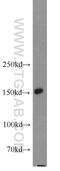 Nephrocystin 3 antibody, 22026-1-AP, Proteintech Group, Western Blot image 