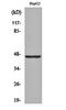 Melanoma-associated antigen 1 antibody, orb161664, Biorbyt, Western Blot image 