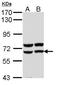 Pancreatic alpha-amylase antibody, TA308172, Origene, Western Blot image 