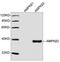 Protein Kinase AMP-Activated Non-Catalytic Subunit Beta 2 antibody, LS-C203277, Lifespan Biosciences, Western Blot image 