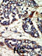Serine/threonine-protein kinase Nek1 antibody, 63-378, ProSci, Immunohistochemistry paraffin image 