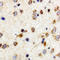 FER Tyrosine Kinase antibody, LS-C358983, Lifespan Biosciences, Immunohistochemistry frozen image 