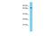 Fermitin Family Member 2 antibody, PA5-46156, Invitrogen Antibodies, Western Blot image 