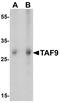 TATA-Box Binding Protein Associated Factor 9 antibody, PA5-72802, Invitrogen Antibodies, Western Blot image 