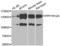 Protein Phosphatase 1 Regulatory Subunit 12A antibody, LS-C334889, Lifespan Biosciences, Western Blot image 