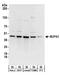 Nucleoporin 43 antibody, A303-976A, Bethyl Labs, Western Blot image 