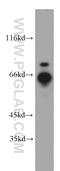 Ring Finger Protein 168 antibody, 21393-1-AP, Proteintech Group, Western Blot image 